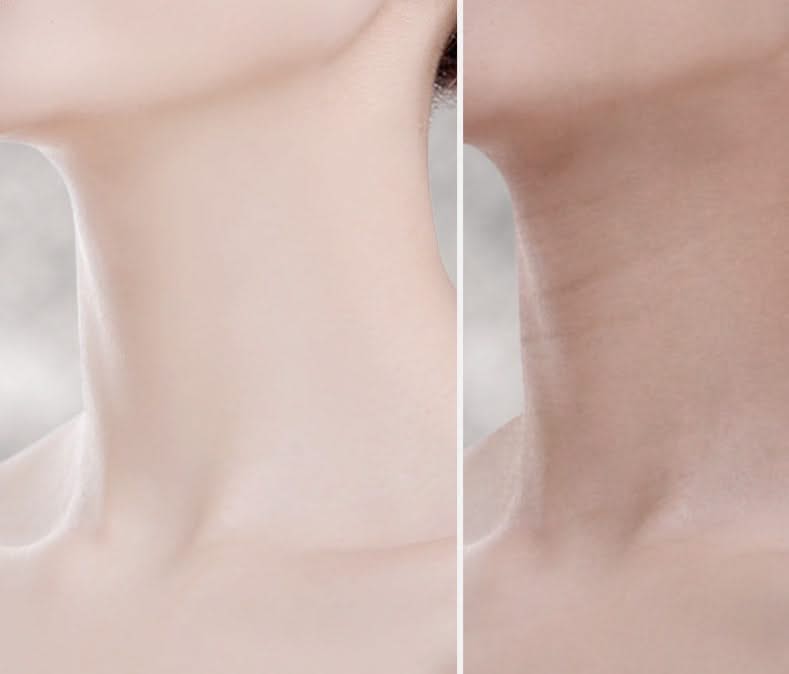 Mauzari™ Massaggiatore Lifting EMS per Viso e Collo