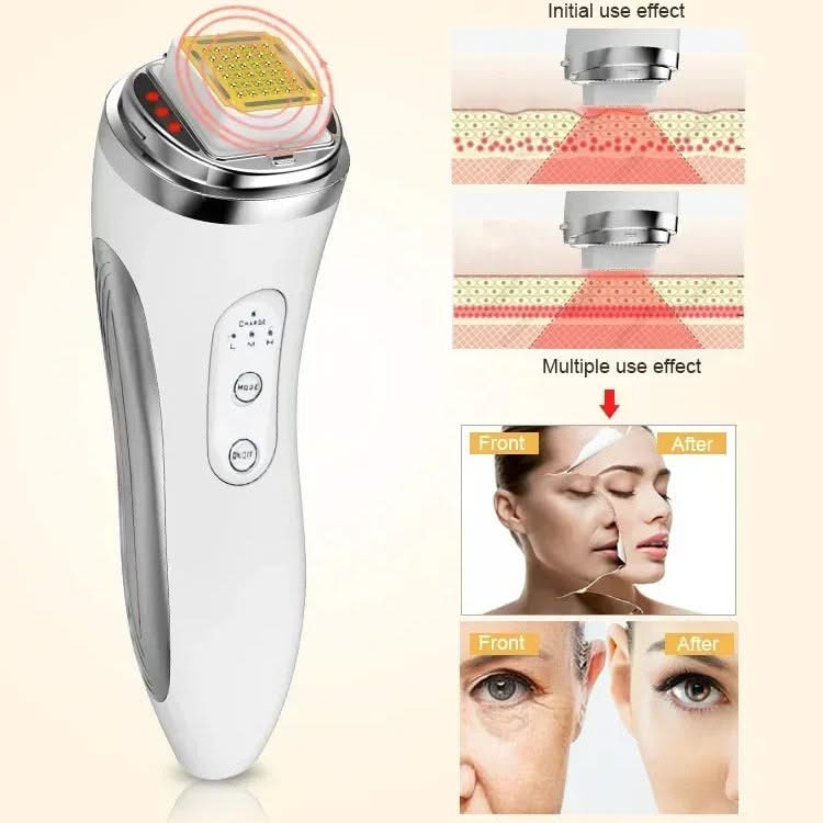 Mauzari™ Dispositivo Viso a Matrice di Punti per Tonificare la Pelle