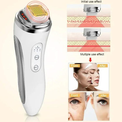 Mauzari™ Dispositivo Viso a Matrice di Punti per Tonificare la Pelle