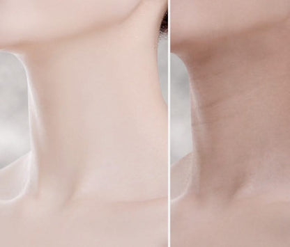 Mauzari™ Massaggiatore Lifting EMS per Viso e Collo