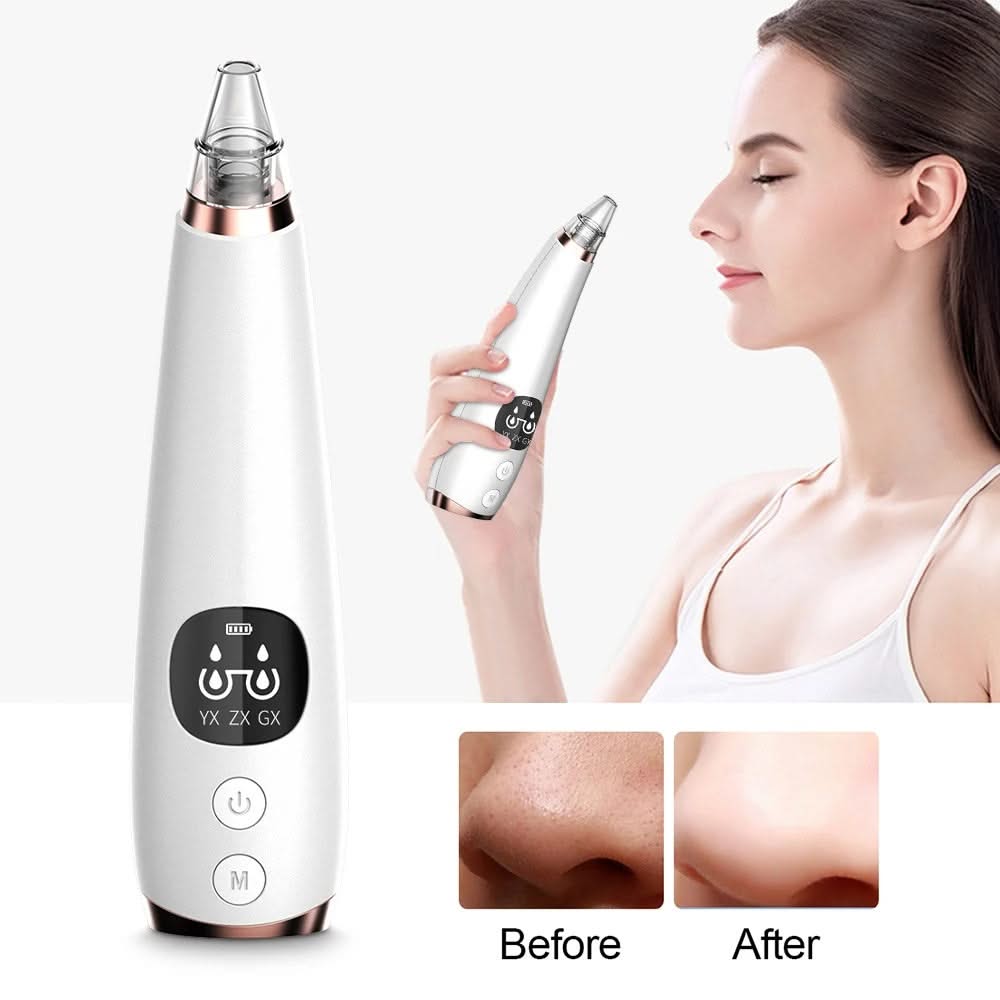 Mauzari™ Aspiratore Elettrico per Punti Neri e Pulizia dei Pori