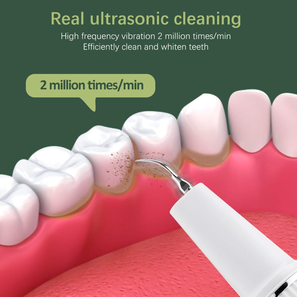 Mauzari™ Pulitore Dentale a Ultrasuoni con Telecamera