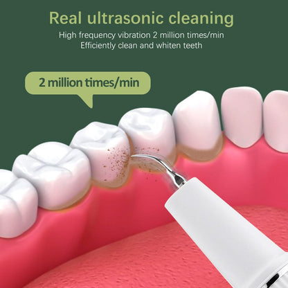 Mauzari™ Pulitore Dentale a Ultrasuoni con Telecamera
