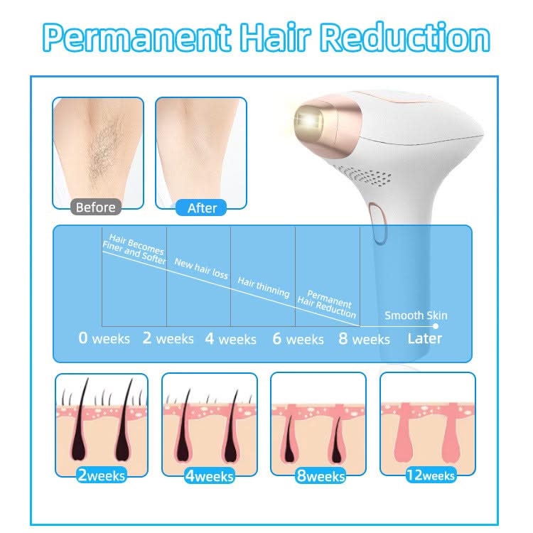 Mauzari™ Epilatore IPL con 9 Livelli per Viso e Corpo