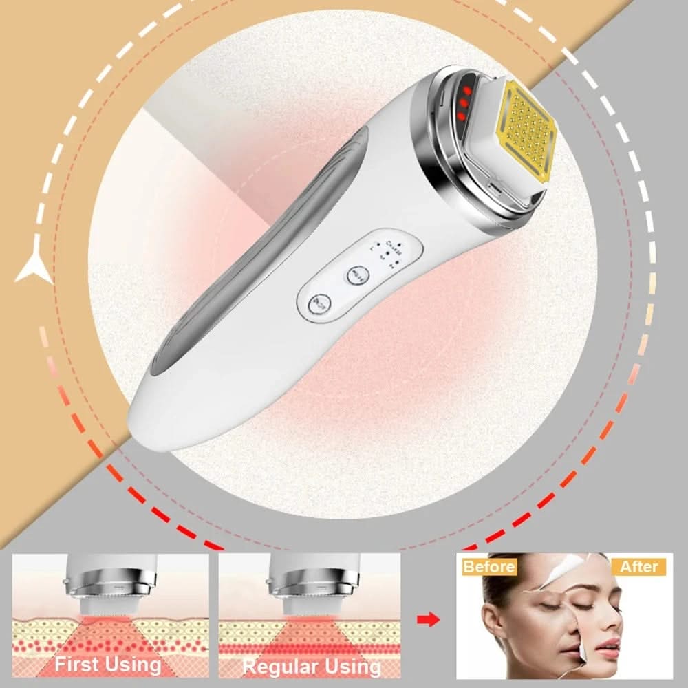 Mauzari™ Dispositivo Viso a Matrice di Punti per Tonificare la Pelle