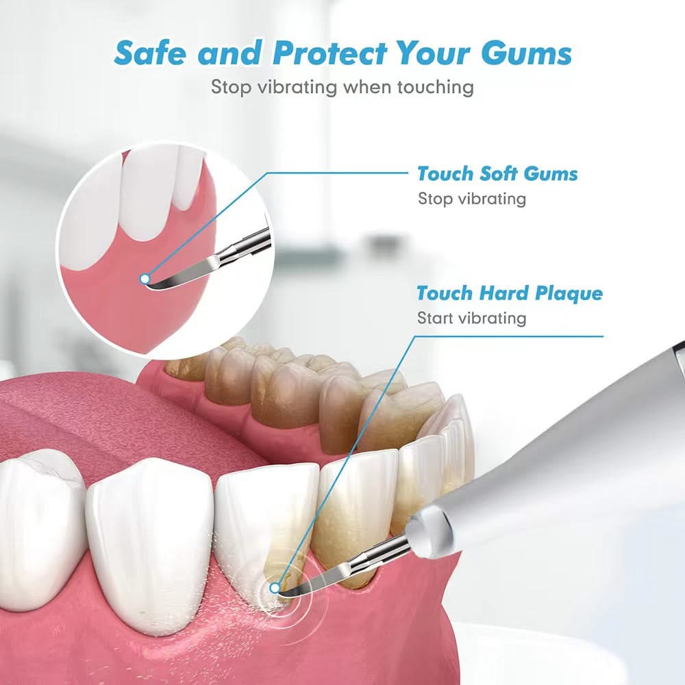 Mauzari™ Pulitore Dentale a Ultrasuoni per Placca, Tartaro e Macchie