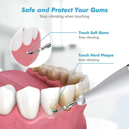Mauzari™ Pulitore Dentale a Ultrasuoni per Placca, Tartaro e Macchie
