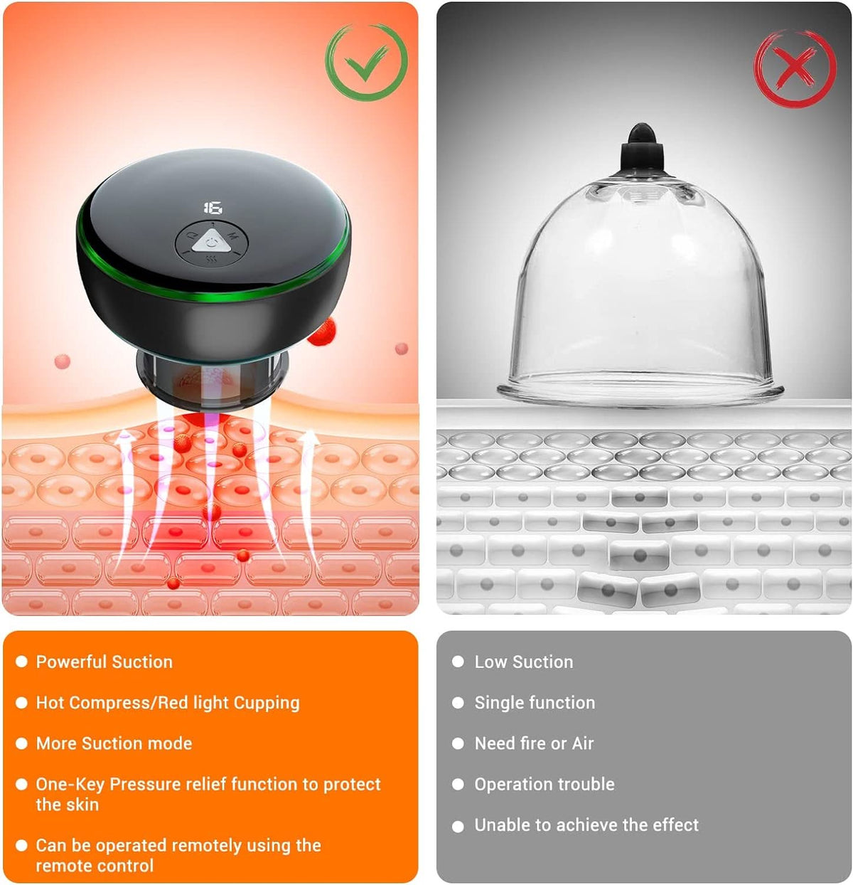 Mauzari™ Dispositivo Intelligente per Coppettazione