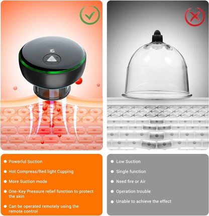 Mauzari™ Dispositivo Intelligente per Coppettazione