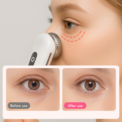 Mauzari™ Dispositivo RF per il Viso con EMS e Terapia LED